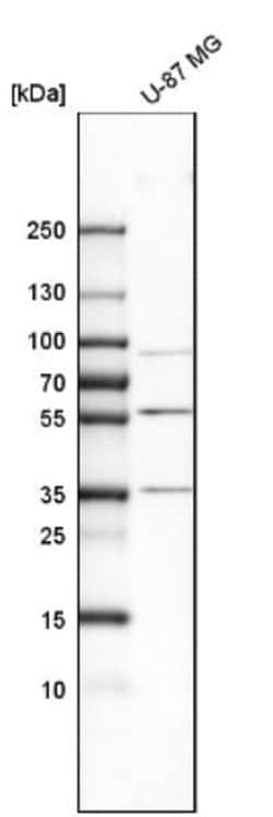 MMP-3 Antibody, Novus Biologicals 0.1mL; Unlabeled:Antibodies, Polyclonal